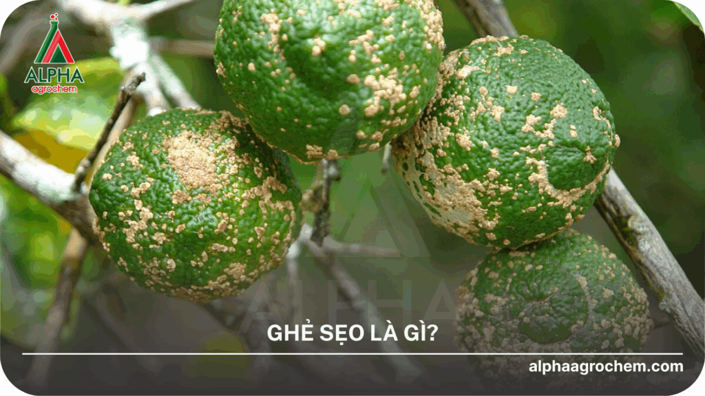 Bệnh ghẻ sẹo là gì?